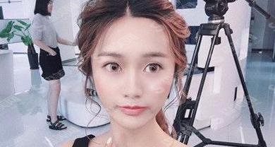 辽宁协和整形医院靠谱吗?眼部手术案例反馈+眼部整形价格收费标准