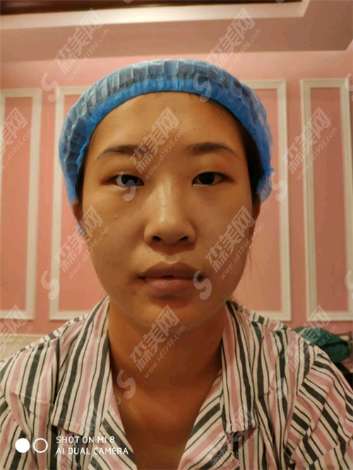 张小红整形医院价格表呈现,张小红整形医院怎么样?真实整形案例分享