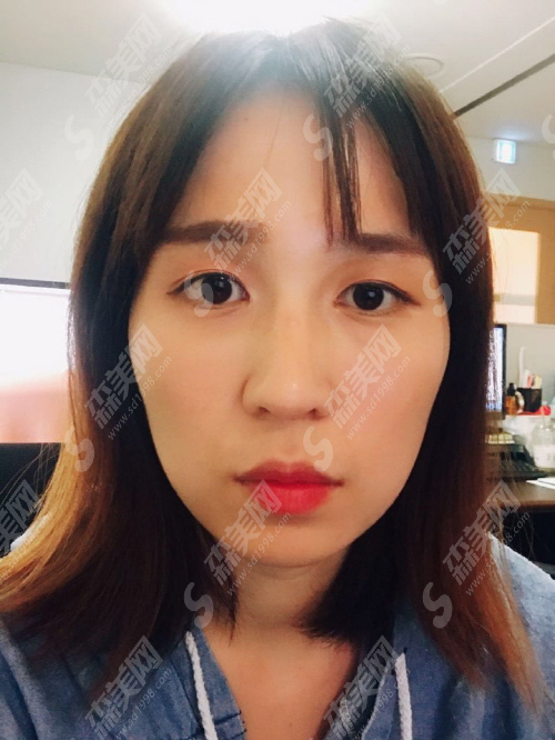 像束激光医院主要治疗什么病?治疗果怎么样?