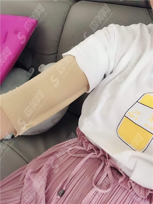 手臂环吸多少钱?环吸与抽脂的区别在哪里?成功手臂环吸案例分享