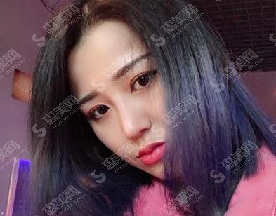 魏紫林医生隆鼻果好吗?专家个人简介/价格参考/案例参考