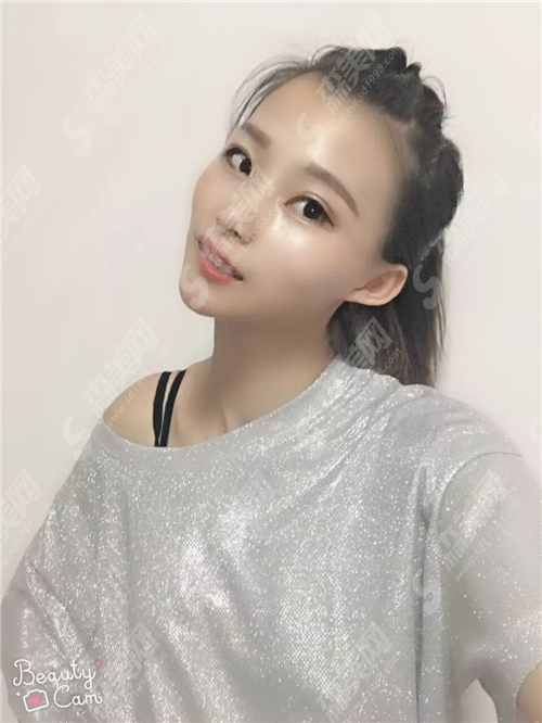 顺德口腔医院收费标准是什么?种牙多少钱?附种牙真实果