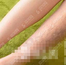 北京长虹激光脱毛价目表2021,激光脱毛后拥有了自信,完成了多年夙愿!