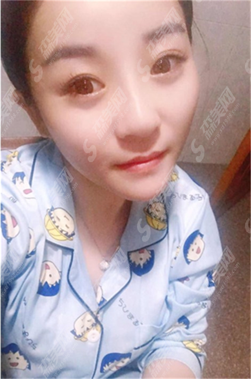 上海第九人民医院热玛吉技术好么?九院医院发展如何?热玛吉真实案例分享