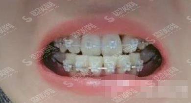 贵阳市口腔医院怎么样?医院简介/矫正案例/医生名单分享