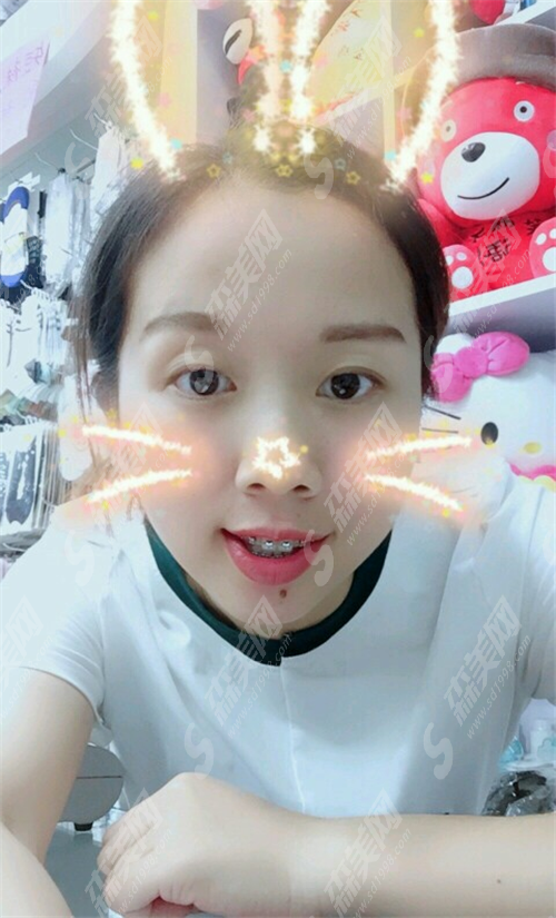 九院口腔科价目表图片真实吗?医院怎样?医院整形实际果好吗?