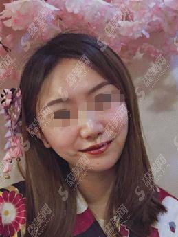 成都恒美植发堪称一绝！医生技术也是很高的！口碑较好！