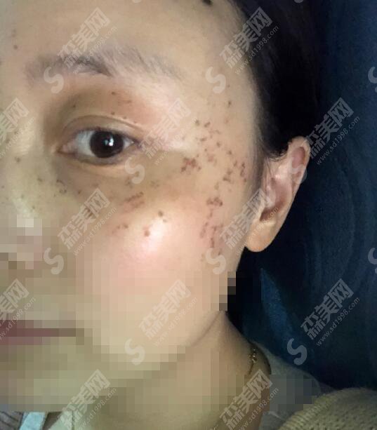 成都维美时尚医学美容医院如何呢？做激光美肤的医生欧海波，郝丽娜怎么样？终于搞清楚整形的真相！