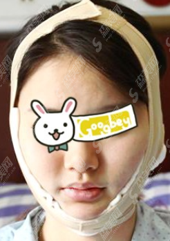 上海九院和上海华美哪个好？医院实力的介绍和医生的特长介绍/附带下颌角整形果一览