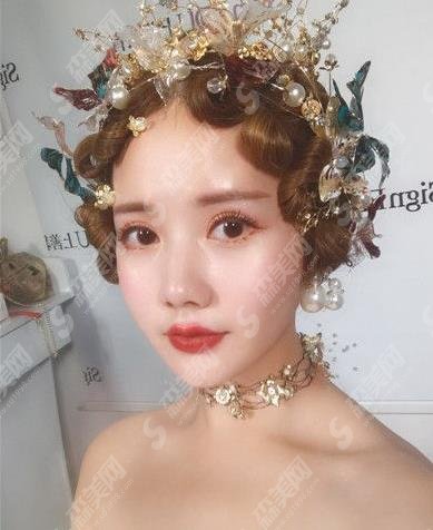 天津市眼科医院整形外科价目表2021，含盖眼部整形案例