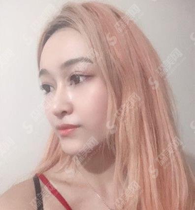 内蒙古医科大学附属人民医院整形外科,2021年度整形价格分享及脂肪填充案例