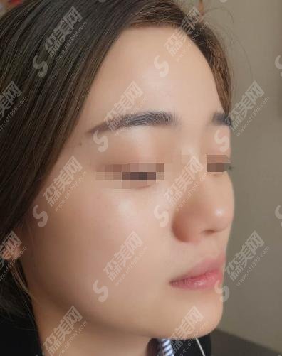 西安美立方和美莱哪个口碑更好?医院介绍及价格全新出炉