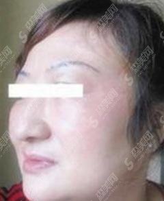沈阳元辰医美特色有哪些？祛斑果稳居第一！频频上热搜