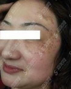 沈阳元辰医美特色有哪些？祛斑果稳居第一！频频上热搜
