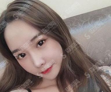 德州市立医院整形美容科发展如何?医院简介及眼部手术案例分享