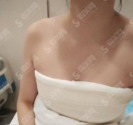 丽江市人民医院整形外科价目表公布，脂肪填充隆胸后使我有了女人魅力吗？