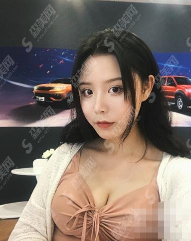 丽江市人民医院整形外科价目表公布，脂肪填充隆胸后使我有了女人魅力吗？