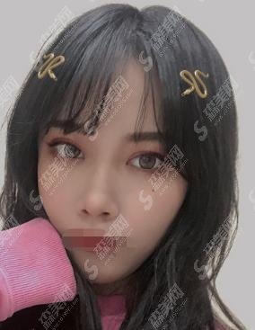 南京中医院整形科医生技术如何？做的双眼皮是否有果？内含2021较新价格表