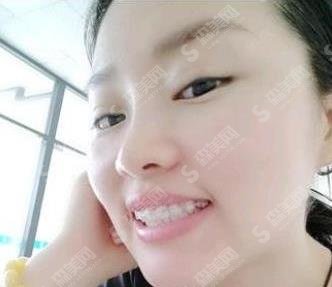 蚌埠市第二人民医院(蚌埠二院)口腔科怎么样,医院简介/医生信息/案例分享