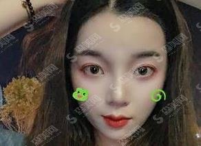 成都星尚美医院怎么样正规不?医院简介/医生介绍/案例分享