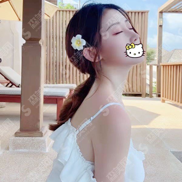 修志夫隆鼻价格标准是怎样的?隆鼻的康复过程图多方面公布,医生实力和价位在线查询!