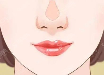 鼻头缩小手术想要果好,这些注意事项要牢记