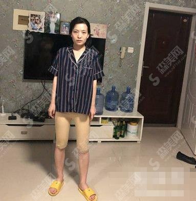 自贡市尚美整形美容医院价目表公布，水动力吸脂果可以吗？