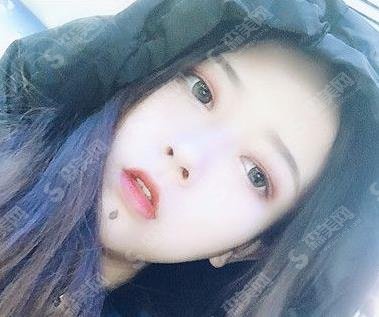 怀化市第一人民医院整形外科眼部整形专业吗？切开双眼皮案例及价格出炉！