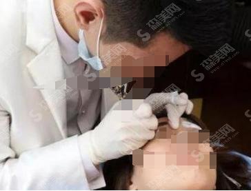 深圳有三甲整容医院吗?北京大学深圳医院纹眉果很棒!