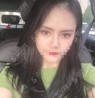 贵州省二院整形科实力如何?刘辉坐诊,医院口碑杠杠的~