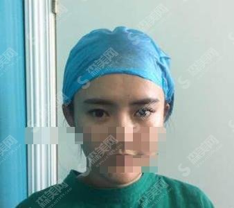 贵州省二院整形科实力如何?刘辉坐诊,医院口碑杠杠的~