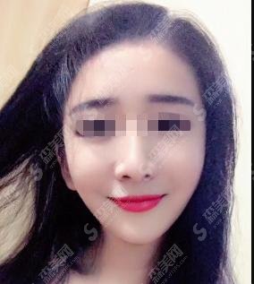 浙一医院做的光子嫩肤怎么样？浙一医院坐诊专家表！