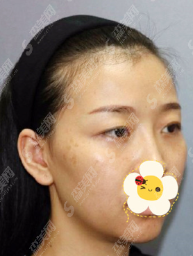 重庆原辰医疗美容医院怎么样?技术/案例全部看,让你妥妥的了解到该院适不适合!