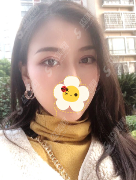 重庆原辰医疗美容医院怎么样?技术/案例全部看,让你妥妥的了解到该院适不适合!