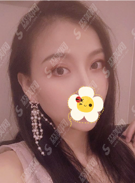 重庆原辰医疗美容医院怎么样?技术/案例全部看,让你妥妥的了解到该院适不适合!