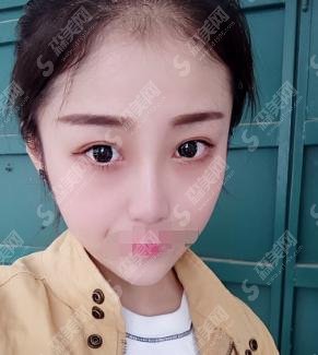 王军医师技术如何?隆鼻找王军靠谱吗?医生坐诊医院曝光&价格表