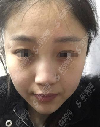 王军医师技术如何?隆鼻找王军靠谱吗?医生坐诊医院曝光&价格表