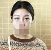 深圳三甲美容医院哪家好？北京大学深圳医院首当其冲！