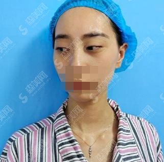 韩国东洋整形外科医院案例精彩分享,果显著值得选择！