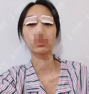韩国东洋整形外科医院案例精彩分享,果显著值得选择！