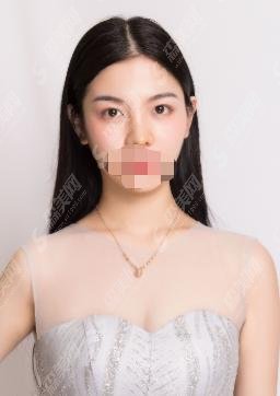 上海九院和华美都是三甲么?九院做的隆鼻都说好!医生实力相当