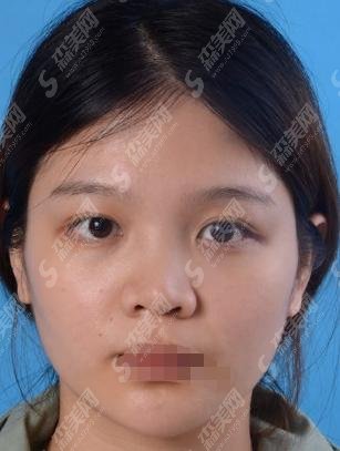 上海九院和华美都是三甲么?九院做的隆鼻都说好!医生实力相当