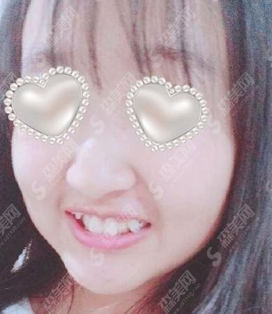 云南省口腔医院综合水平怎么样?真实案例在线了解&价格表