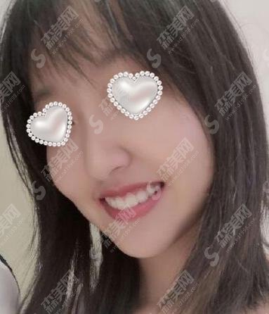 云南省口腔医院综合水平怎么样?真实案例在线了解&价格表