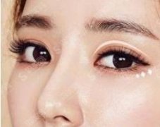 上海双眼皮医生排名前十，看看这些医生当中有没有你青睐的呢？