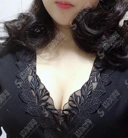 郑州美丽时光整形医院杨瑞国隆胸技术可以吗?个人简介/案例分享/价格查询