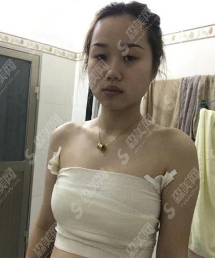 上海第九人民医院整形外科王涛医生隆胸做的如何?隆胸案例分享及医生简介