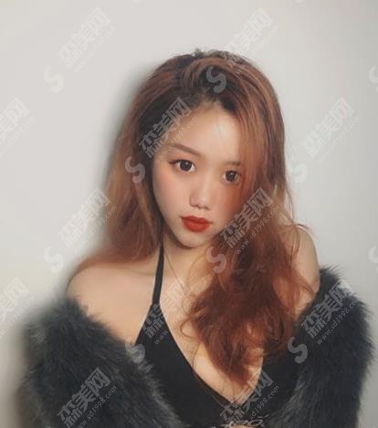 上海第九人民医院整形外科王涛医生隆胸做的如何?隆胸案例分享及医生简介