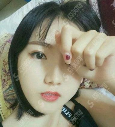 杭州市一医院贾明隆鼻做的可以吗?个人简介/隆鼻案例/价格查询