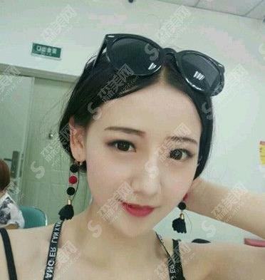 杭州市一医院贾明隆鼻做的可以吗?个人简介/隆鼻案例/价格查询